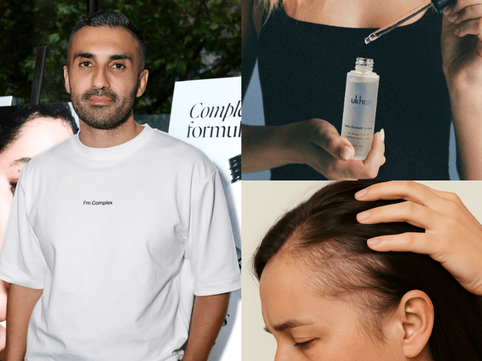 “I Have Traction Alopecia. When Is It Too Late to Reverse?” - UKLASH