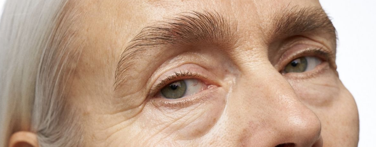 Why Do Eyelashes Fall Out During Menopause? Causes and Tips