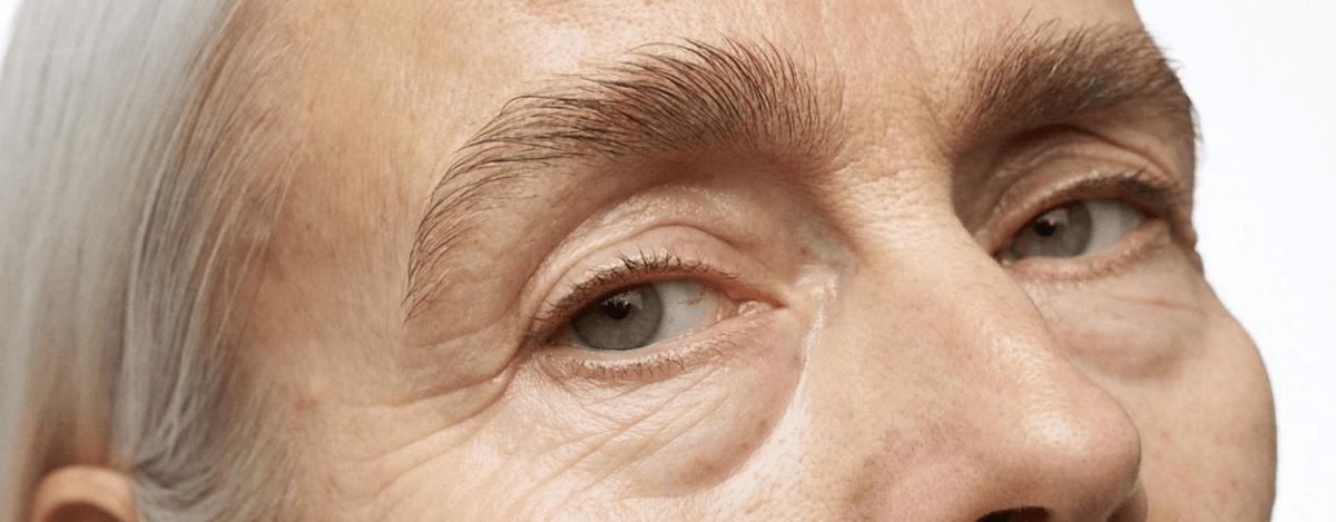 Why Do Eyelashes Fall Out During Menopause? Causes and Tips - UKLASH