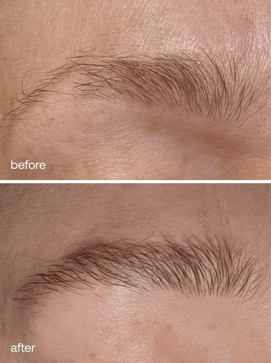 Eyebrow Growth Serum - UKLASH