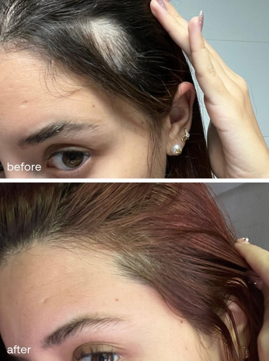 Eyelash and Hair Growth Serum Set - UKLASH