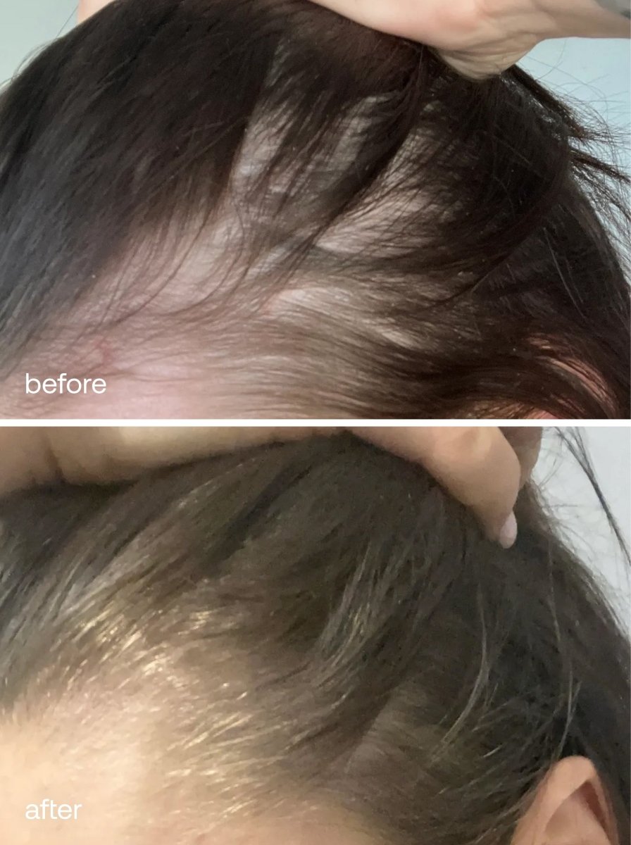 Hair Vitamins - UKLASH