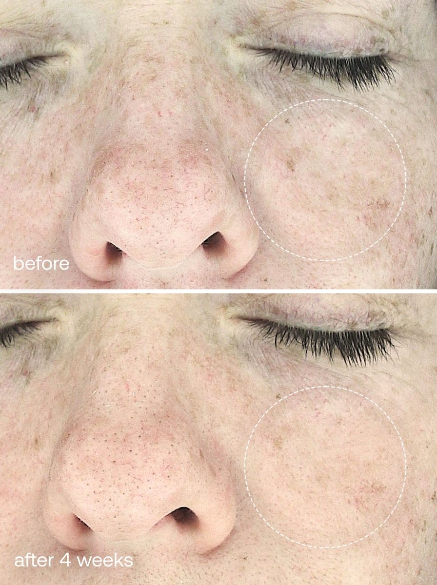 LED Dual Light Pro - Therapy Face Mask - UKLASH