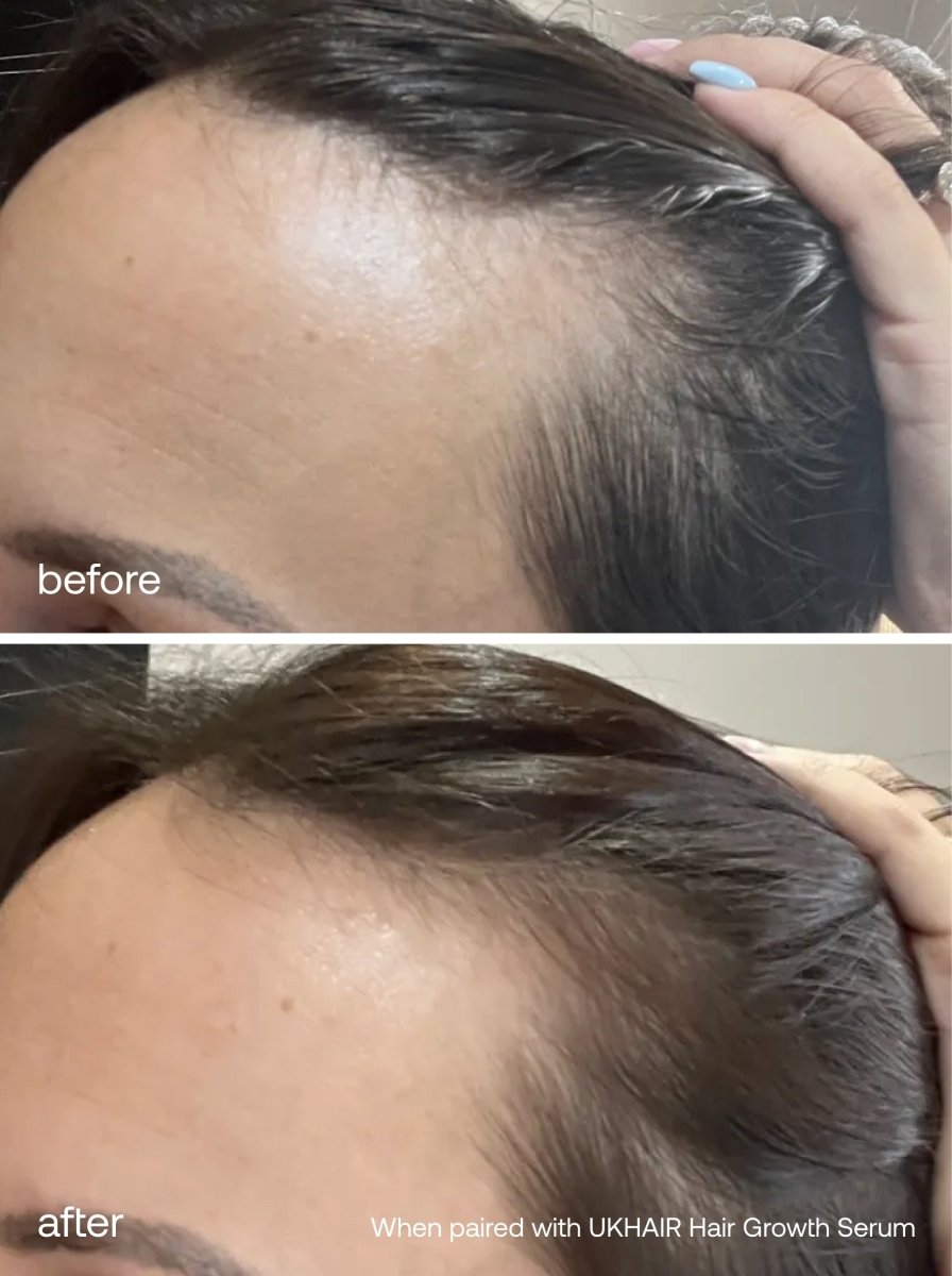 The Mini Hair Care Essentials - UKLASH