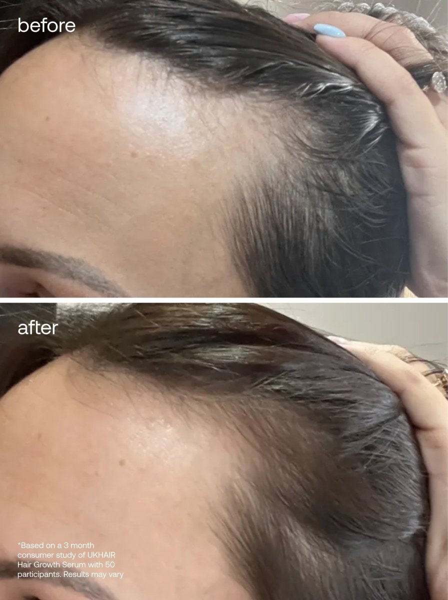 The Scalp To Strand Set x Tangle Teezer - UKLASH