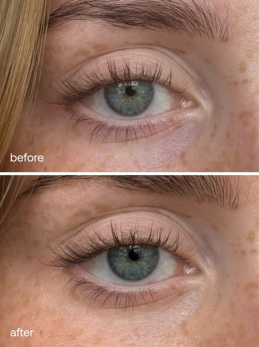 Vitamin C + HA Eye Serum - UKLASH