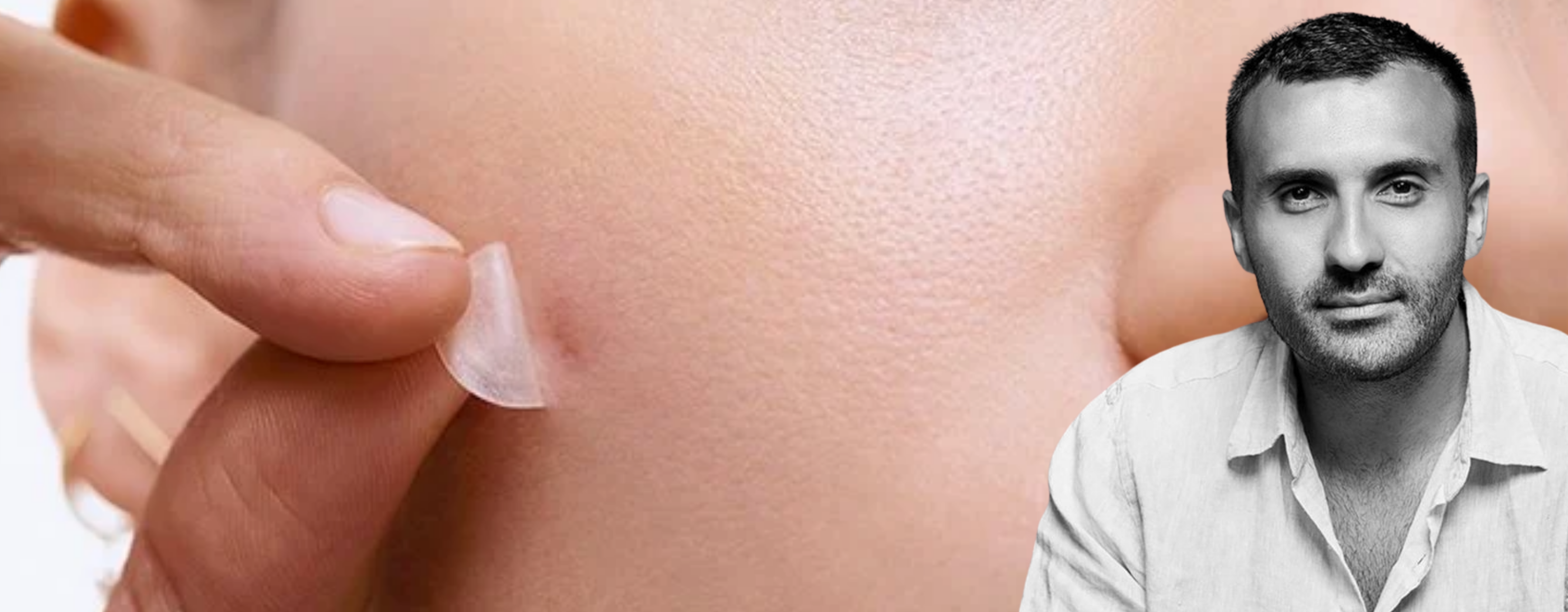 Nima Knows: Does Biotin Make Your Skin Break Out?