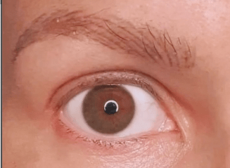 How I Regrew My Eyelashes After Chemo With UKLASH Eyelash Serum - UKLASH