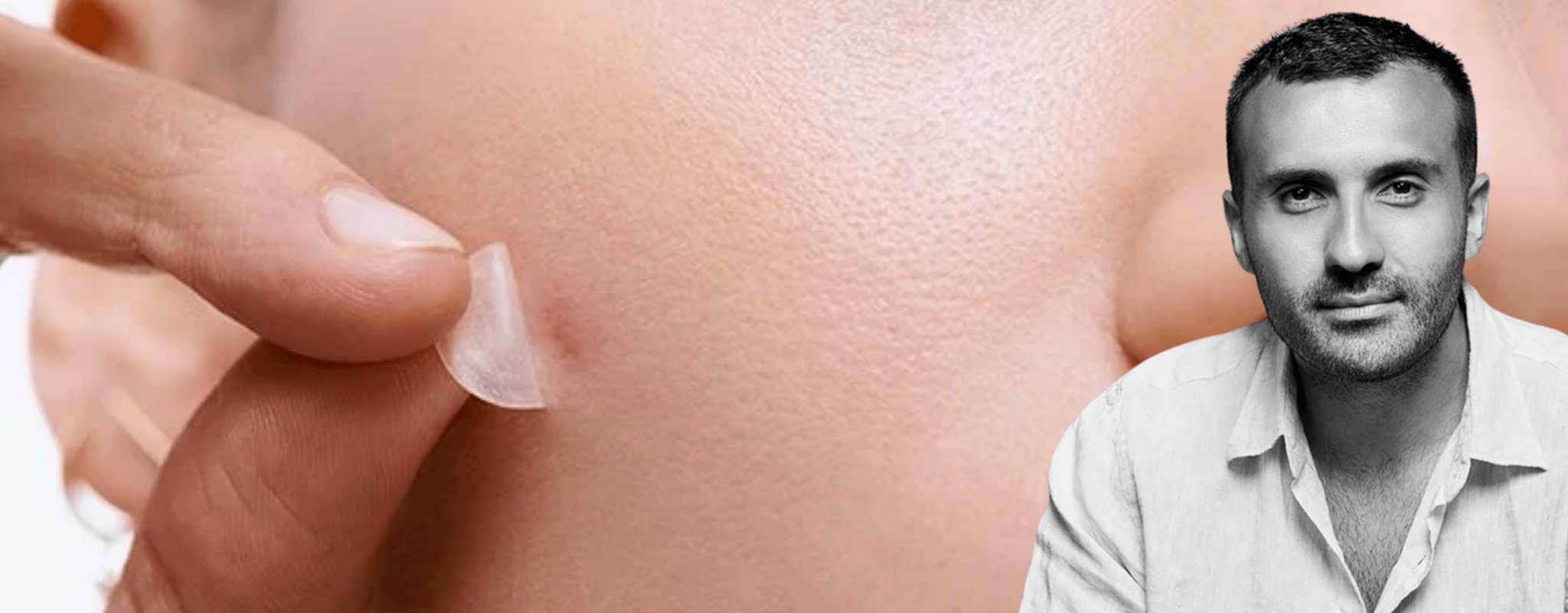 Nima Knows: Does Biotin Make Your Skin Break Out? - UKLASH