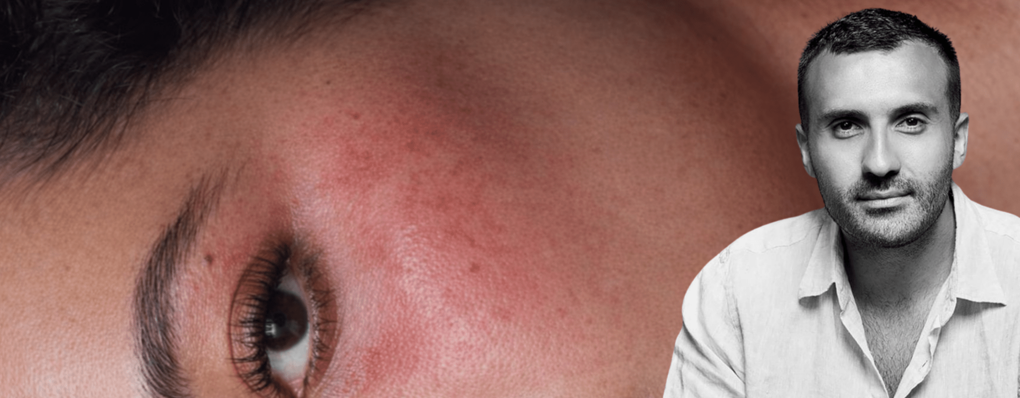 Nima Knows: How To Repair Skin Barrier & Stay Moisturised Through Winter - UKLASH