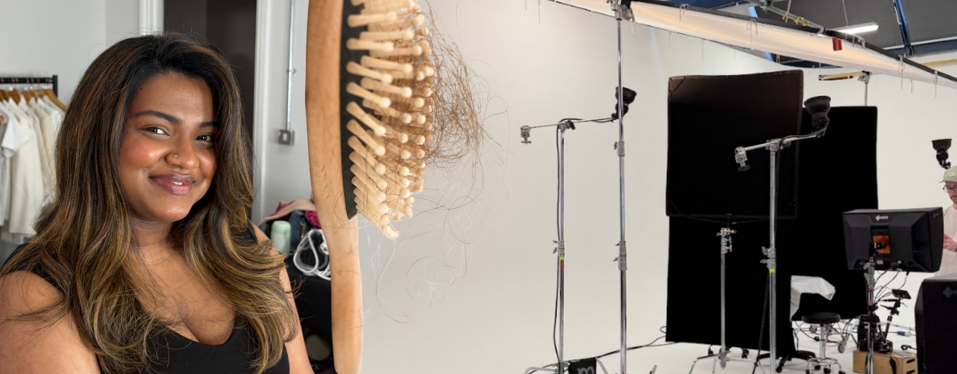 “PCOS Isn’t Just Periods, It’s Hair Loss Too” Understanding The Impact of PCOS and Hair Loss