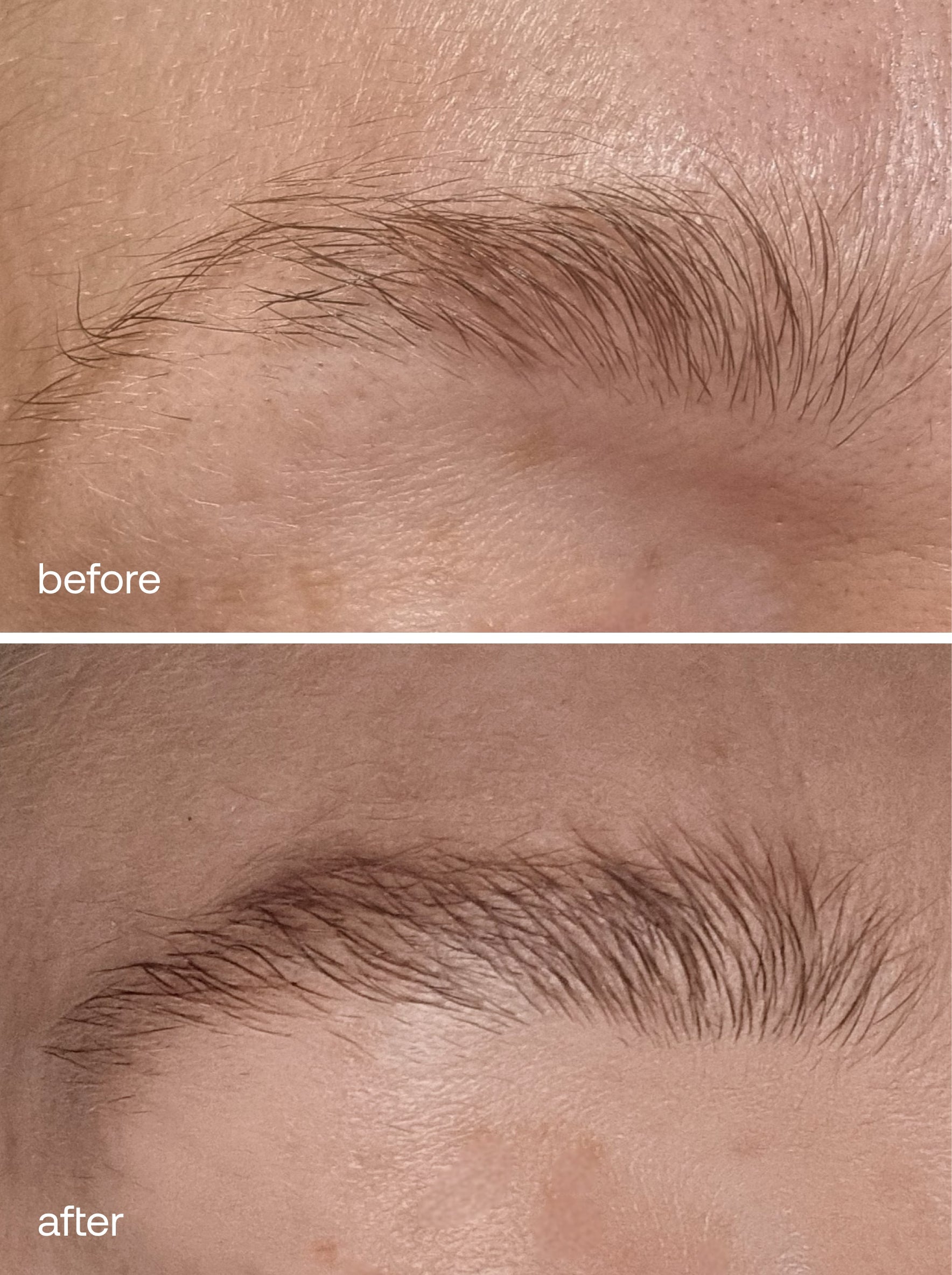 Eyebrow Growth Serum - UKLASH