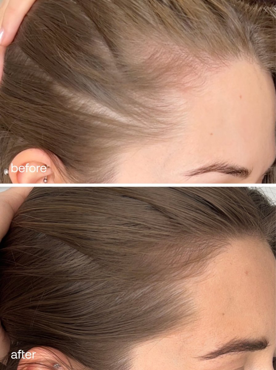 Advanced Hair Supplements - UKLASH