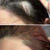 Advanced Scalp Dermaroller - UKLASH
