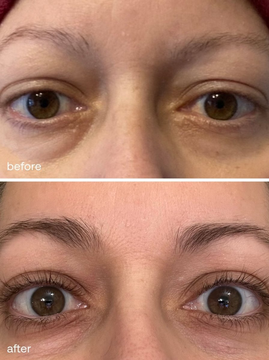 Eyebrow Growth Serum Duo Set - UKLASH