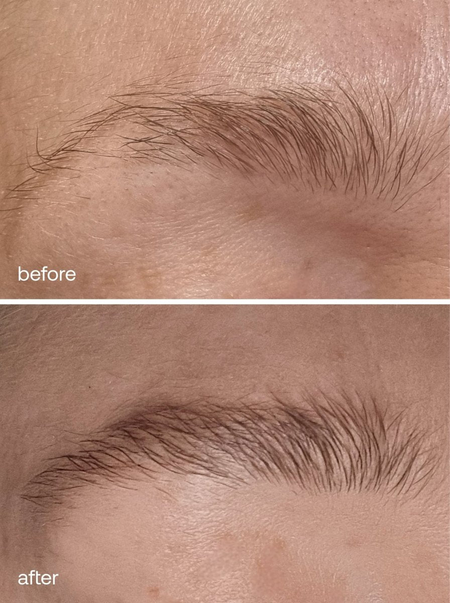 Eyebrow Growth Serum Duo Set - UKLASH