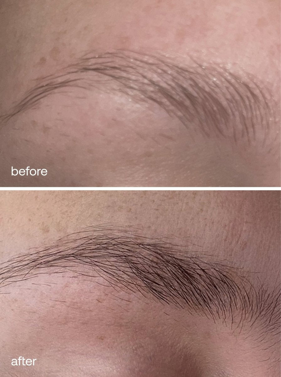 Eyebrow Growth Serum - UKLASH