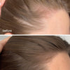 Hair Growth Serum + Advanced Hair Supplements - UKLASH