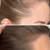 Hair Growth Serum + Advanced Hair Supplements - UKLASH