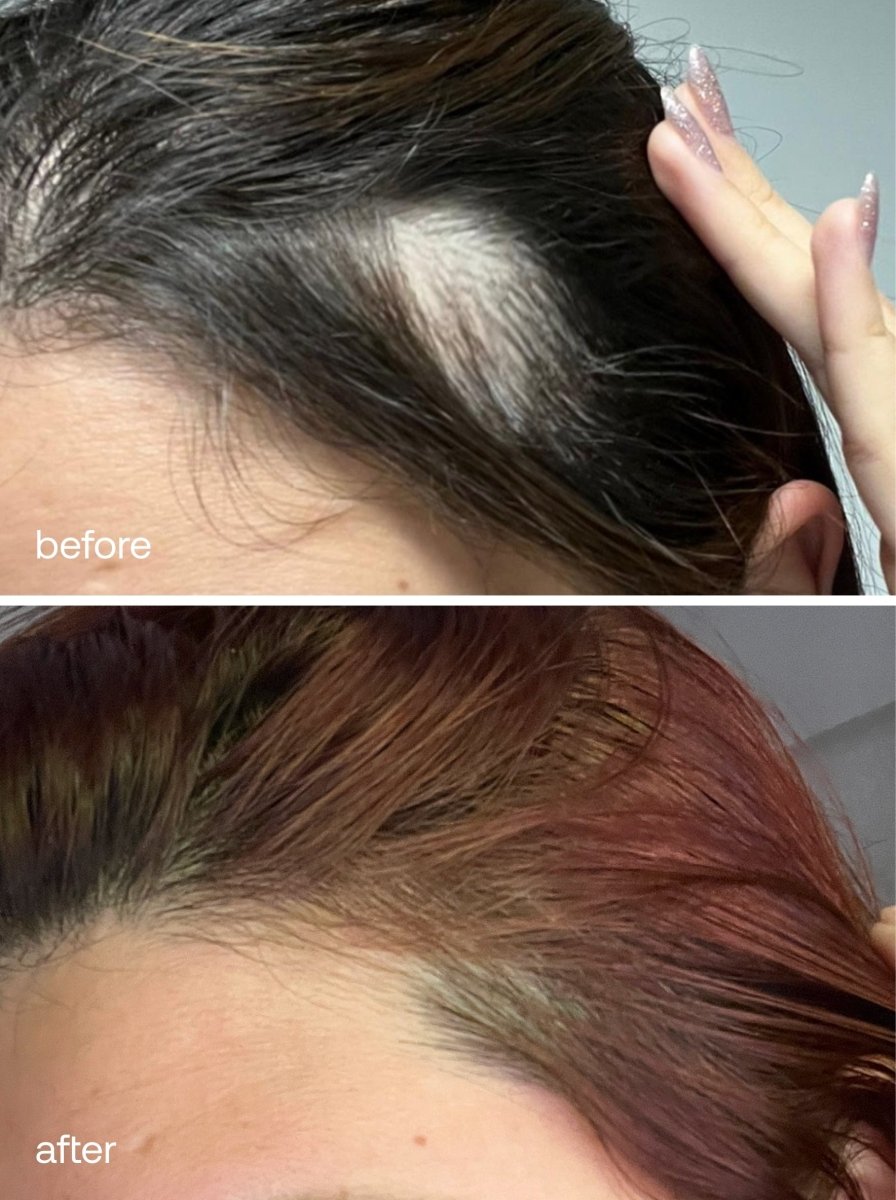 Hair Growth Serum - UKLASH