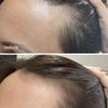 Hair Growth Serum - UKLASH