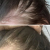 Hair Growth Serum - UKLASH