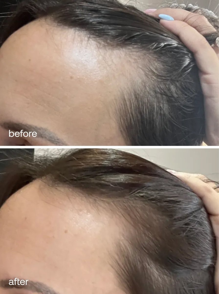 Hair Vitamins - UKLASH