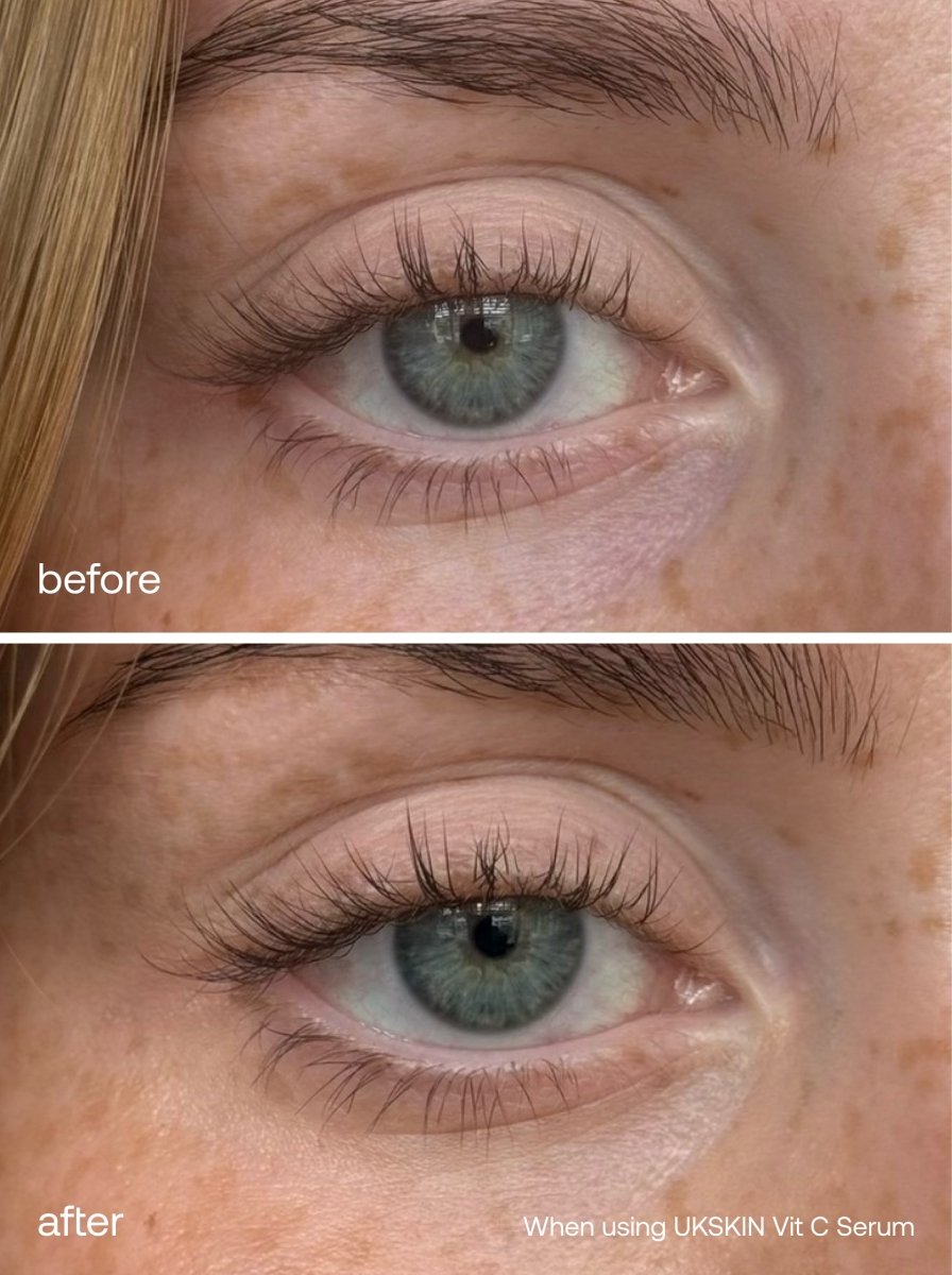 Lash Growth Serum + HA Eye Serum Set - UKLASH