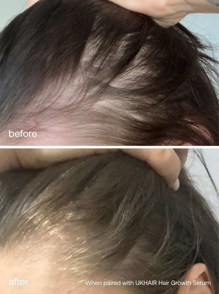 Lash Growth Serum + Hair Vitamins Set - UKLASH