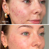 LED Dual Light Pro-Therapy Face Mask - UKLASH