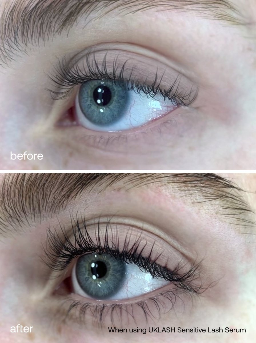 Sensitive Lash Growth Serum + Eyebrow Growth Serum Set - UKLASH