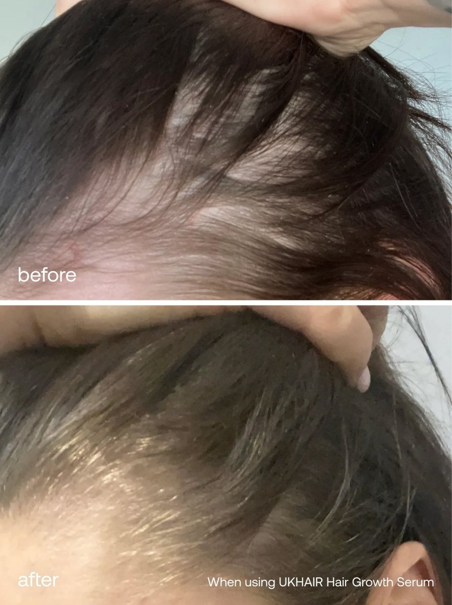 The Hair Growth Foundation Set - UKLASH